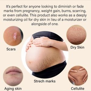 Organic oil removal pregnancy mark